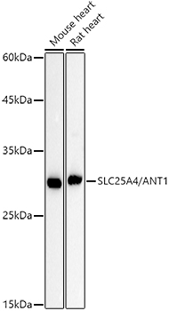 Adenine Nucleotide Translocase 1 Antibody (3C1Q3)