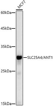 Adenine Nucleotide Translocase 1 Antibody (3C1Q3)