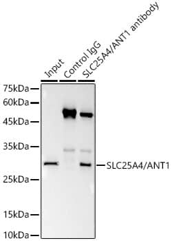 Adenine Nucleotide Translocase 1 Antibody (3C1Q3)