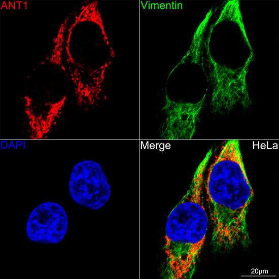 Adenine Nucleotide Translocase 1 Antibody (3C1Q3)