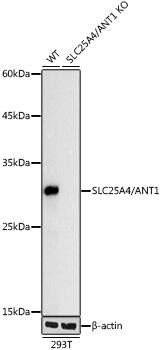 Adenine Nucleotide Translocase 1 Antibody (3C1Q3)