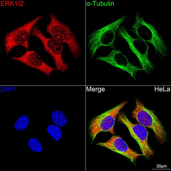 ERK1/2 Antibody (2Z8O1)