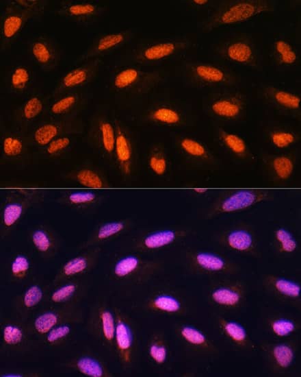 PCAF Antibody