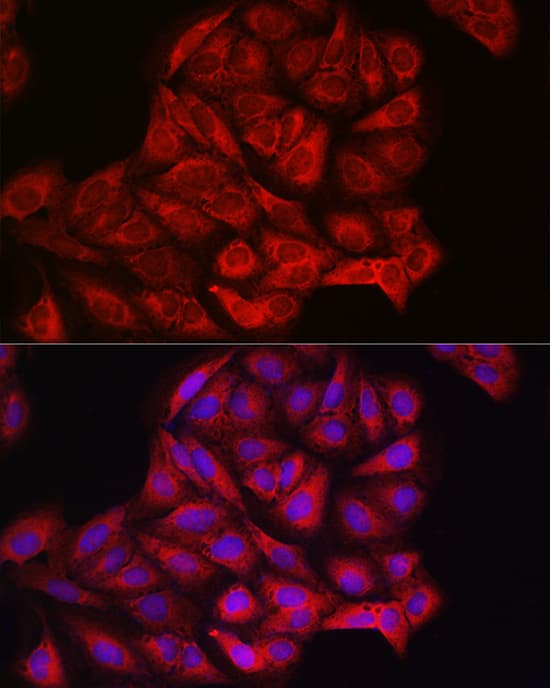 PIK3CA Antibody