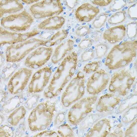PIK3CA Antibody