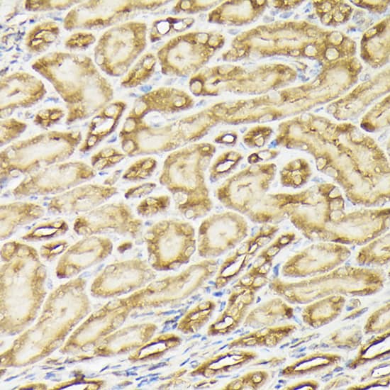 PIK3CA Antibody