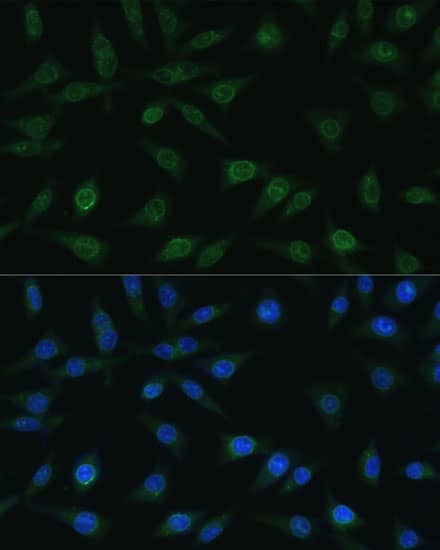 NUP98 Antibody