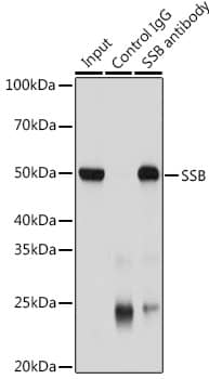 SSB Antibody