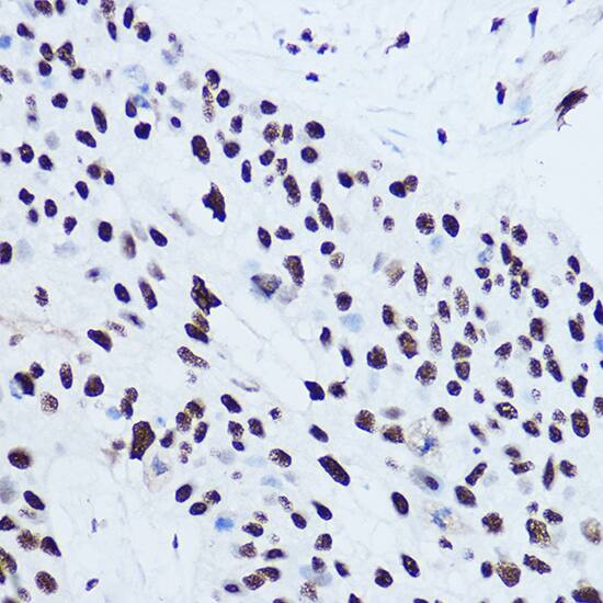 SSB Antibody