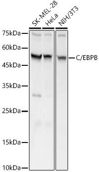 CEBP Beta Antibody