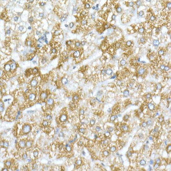 VDAC1 Antibody