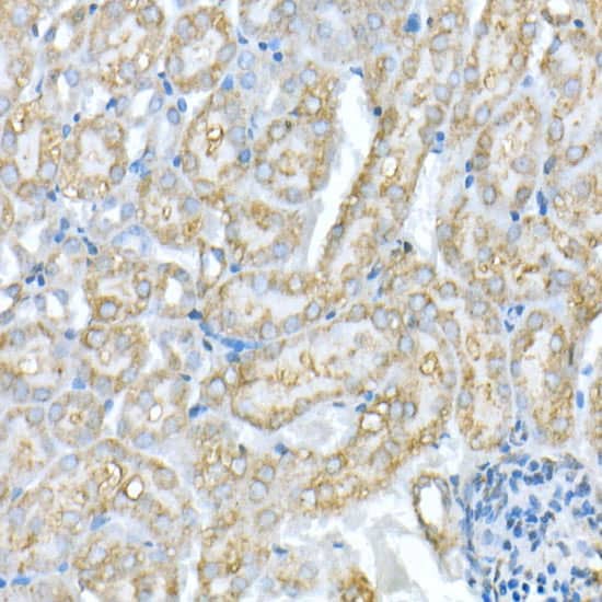 VDAC1 Antibody