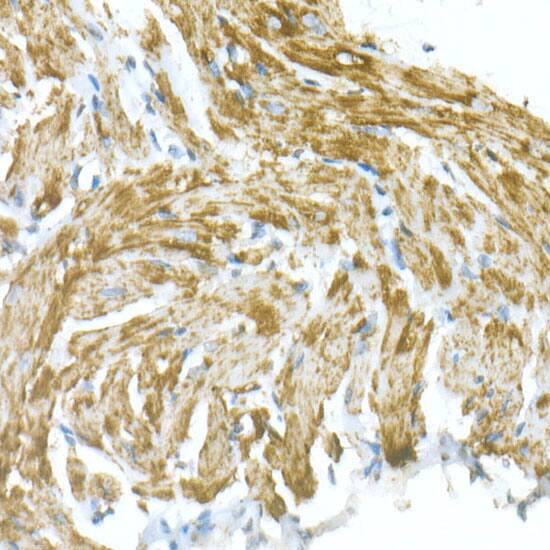VDAC1 Antibody