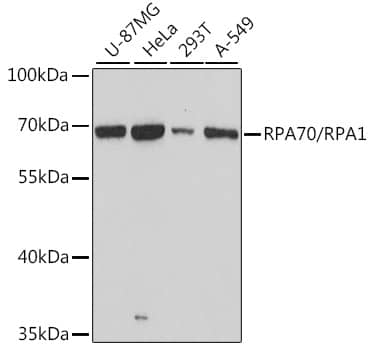 RPA70 Antibody