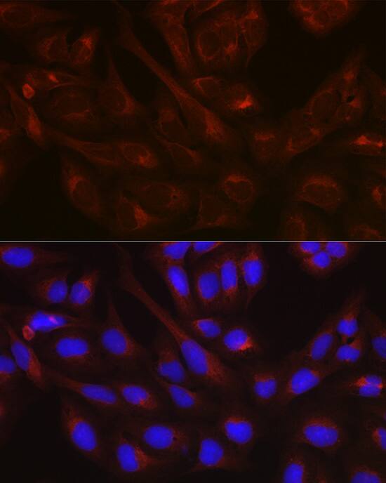 NSF Antibody