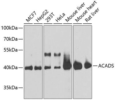 ACADS Antibody