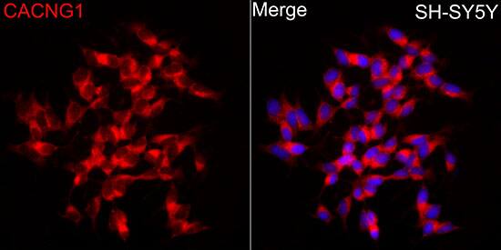 CACNG1 Antibody