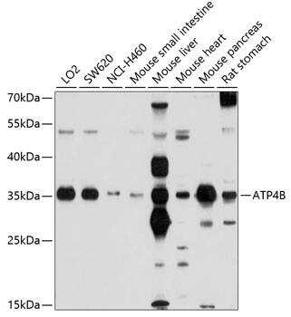 Hydrogen Potassium ATPase Beta Antibody