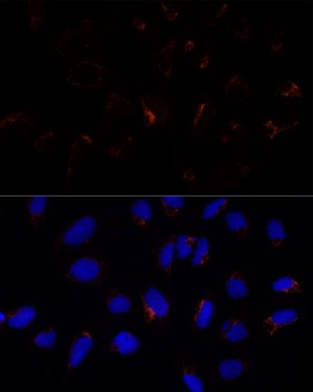 ETHE1 Antibody
