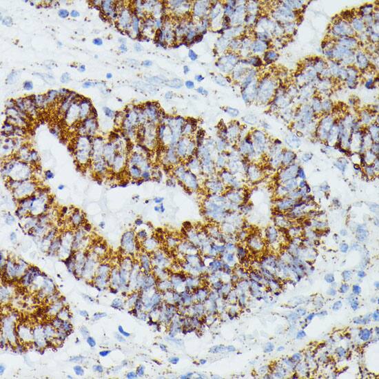 ETHE1 Antibody