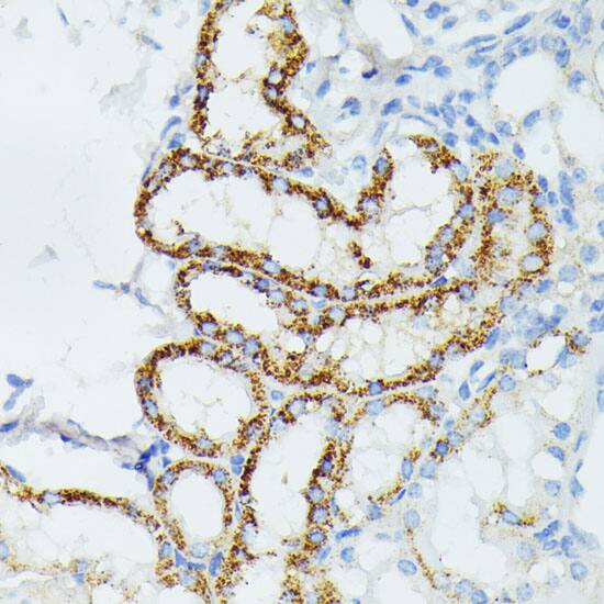 ETHE1 Antibody