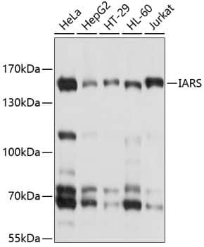 Isoleucyl tRNA synthetase Antibody