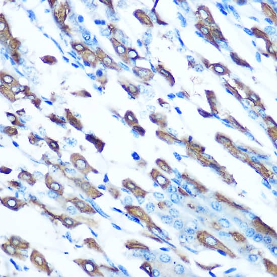 NRAMP2/SLC11A2/DMT1 Antibody