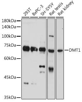 NRAMP2/SLC11A2/DMT1 Antibody