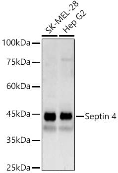 Septin-4 Antibody