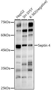 Septin-4 Antibody