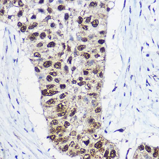 SMARCA1 Antibody