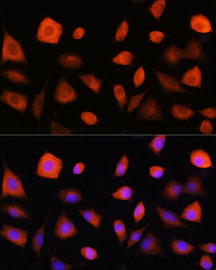 eIF2B epsilon Antibody