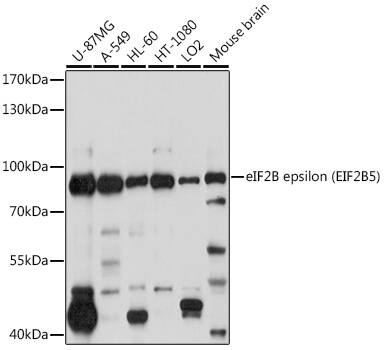 eIF2B epsilon Antibody