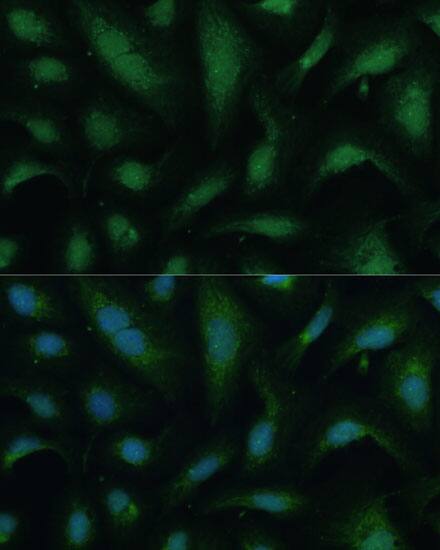 KIF14 Antibody