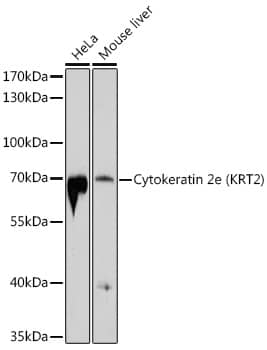 Cytokeratin 2 Antibody