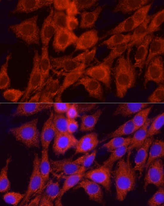 GCLC Antibody