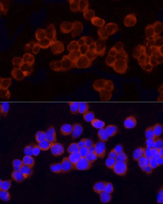 GCLC Antibody