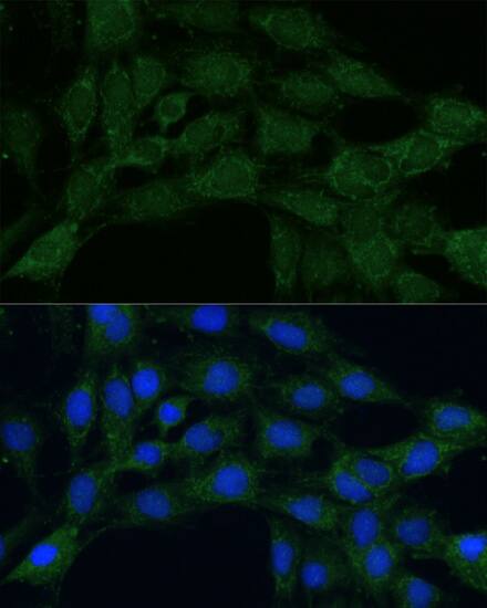 MTHFD2 Antibody