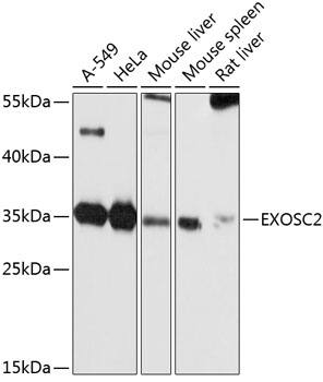 RRP4 Antibody