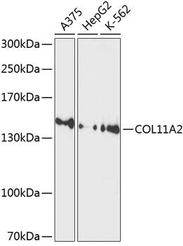 Collagen XI alpha 2 Antibody