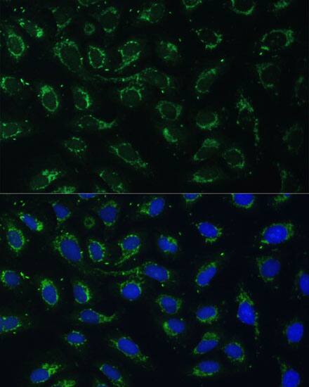 AKR1C2 Antibody