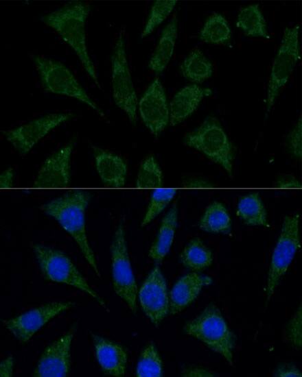 AKR1C2 Antibody