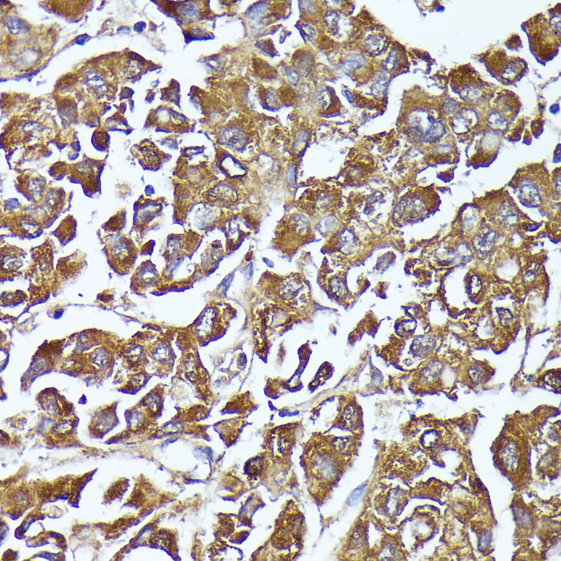 AKR1C2 Antibody