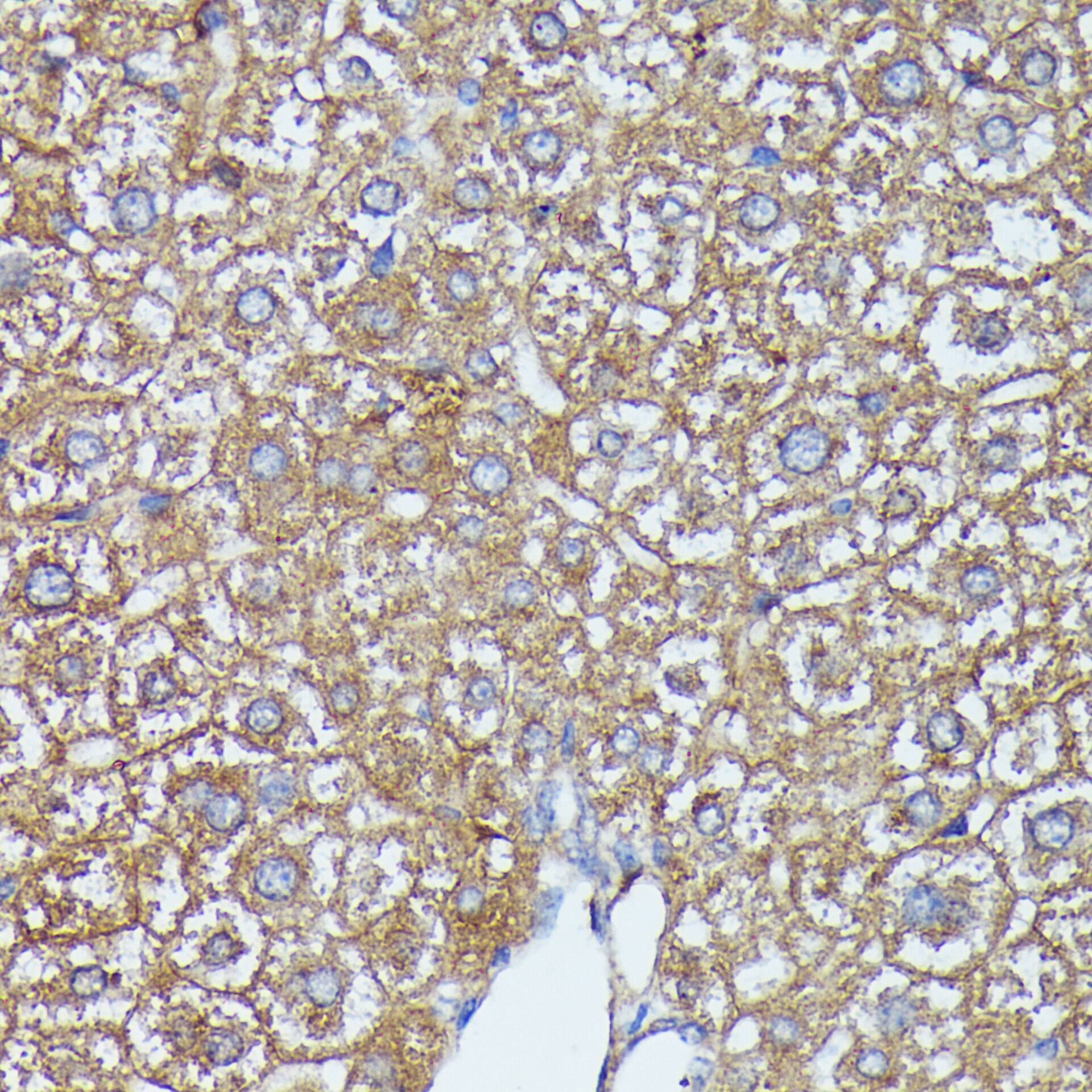 AKR1C2 Antibody