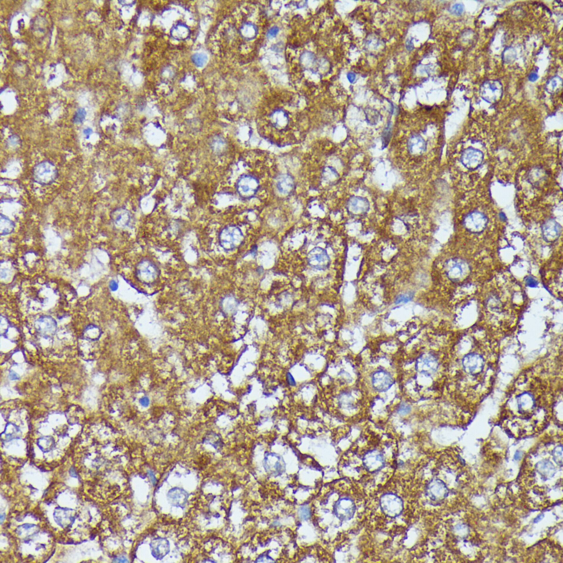 AKR1C2 Antibody