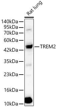 TREM2 Antibody