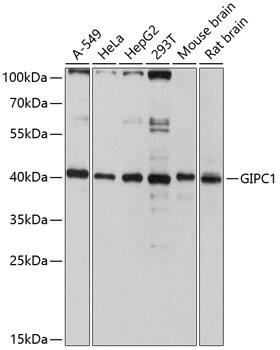 GIPC1 Antibody