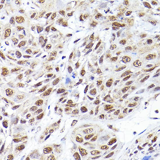 SEC14L2 Antibody