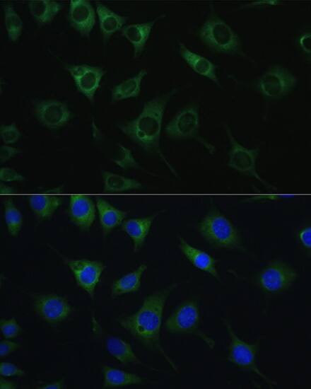 SRPRB Antibody