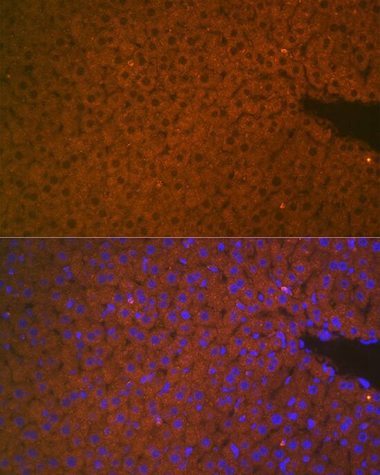 Matriptase 2 Antibody